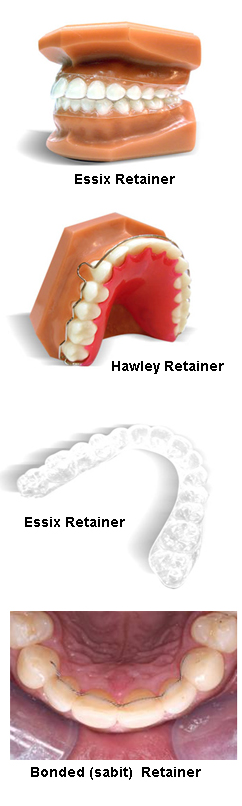 Retainer (Pekiştirme) Ortodonti Retansiyon Apareyleri